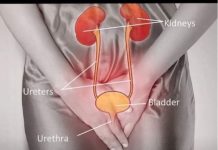 Savjet ljekara: Šta učiniti kada patite od učestalog mokrenja, bolnog mokrenja i hitnosti