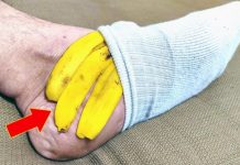 NIKAD ne baca koru od banane: On to može učiniti ako je stavite na nogu!