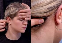 STANJE OD KOG UMRE SVAKI 3. ČOVJEK VAS UPOZORAVA SEDMICU PRIJE: Doktor otkrio da MIJEŠAMO SIMPTOME – “To nije migrena!”