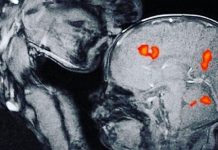 Kako majčin poljubac utječe na mozak djeteta? Naucnici su otkrili nesto nevjerovatno!