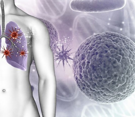 7 simptoma raka koje 90 posto ljudi ignorira