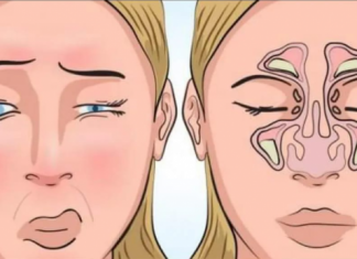 Glava boli na svaku promjenu vremena – OVO JE NAJMOĆNIJI LIJEK ZA SINUSE: Uradite ovo prije spavanja i SVE ĆE PROČISTITI