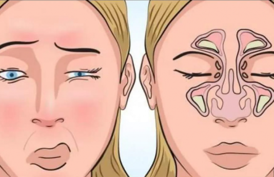 Glava boli na svaku promjenu vremena – OVO JE NAJMOĆNIJI LIJEK ZA SINUSE: Uradite ovo prije spavanja i SVE ĆE PROČISTITI