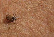 Ova namirnica je spas ako vam se krpelj zakači za kožu: Samo je pospite po njemu