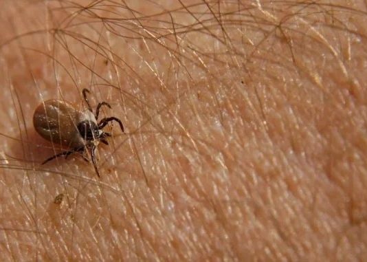 Ova namirnica je spas ako vam se krpelj zakači za kožu: Samo je pospite po njemu