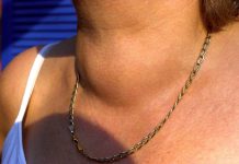 Za kafu smo svi znali, ali i ovo povrće je najgore za štitnu žlezdu: Zaboravite na njega odmah, može da dovede do..