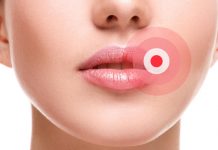 Ako ste ga ikada imali OVO u ustima, trebali biste znati šta je u pitanju, i kako da se toga riješite..