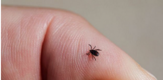 Počela je sezona krpelja, evo kako se zaštiti i kako ga odstraniti iz kože