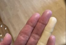 Ovo su posljedice spavanja sa….