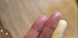 Ovo su posljedice spavanja sa….