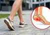 Ako osećate oštar probadajući bol u stopalu: Najgore vam ujutru? Evo šta elitni doktori savetuju
