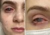 Popila tabletu protiv bolova koju uzimaju mnogi, a onda joj se život zauvijek promijenio Popila tabletu protiv bolova koju uzimaju mnogi, a onda joj se život zauvijek promijenio - featured image